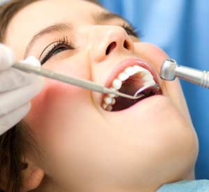 Teeth Cleanings & Checkups