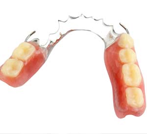 Partial Dentures